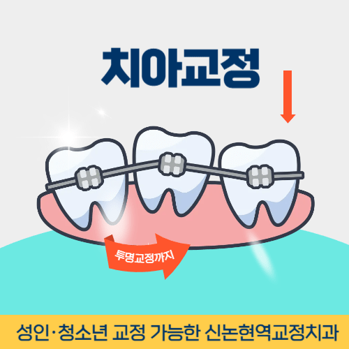 포항치과 포항시 치과 치아교정