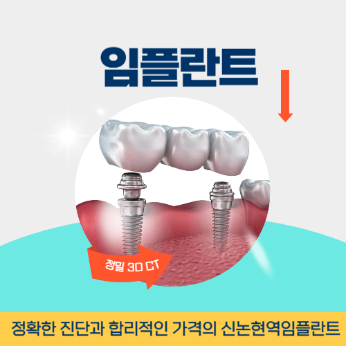포항치과 포항시 치과 임플란트