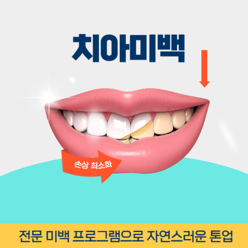 포항치과 포항시 치과 치아미백