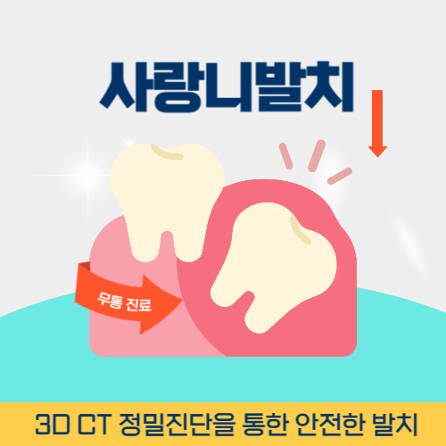 포항치과 포항시 치과 사랑니 발치